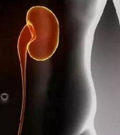 腎功能檢查前有哪些注意事項(xiàng)