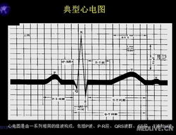 心電圖基礎知識講解,心電圖教學基礎知識,心電圖入門基礎知識