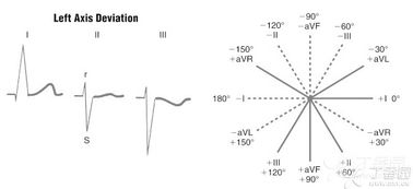 心電圖基礎(chǔ)知識與識別
