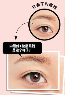 整形類(lèi)基礎(chǔ)知識(shí)