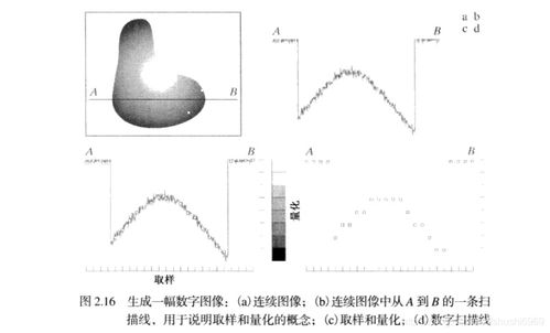 醫(yī)療數(shù)字影像基礎(chǔ)知識(shí)