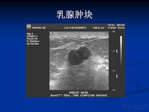 超聲診斷基礎(chǔ)知識