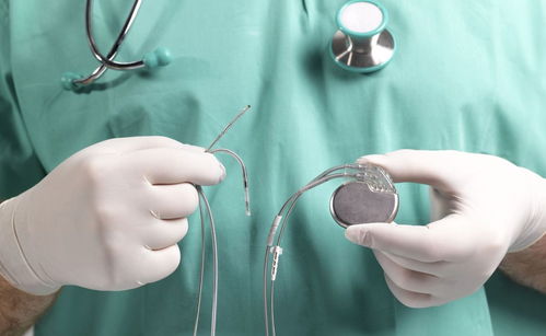 起搏器,基礎(chǔ)知識(shí),概述,心臟