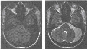 mri檢查基礎(chǔ)知識