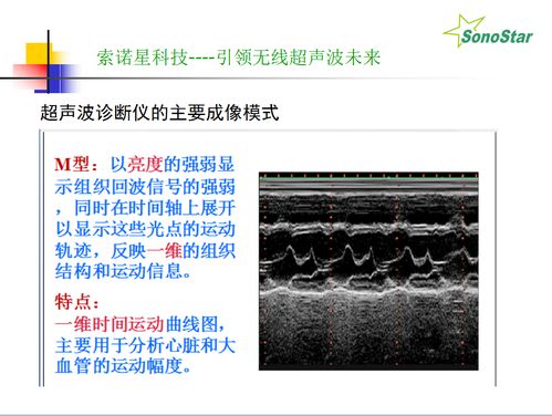 b超基礎(chǔ)知識(shí)麻醉科