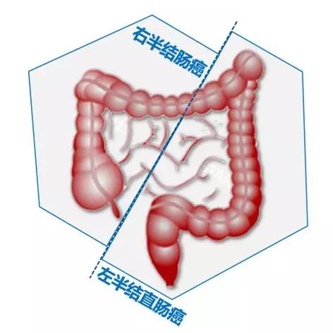 結(jié)直腸癌基礎(chǔ)知識